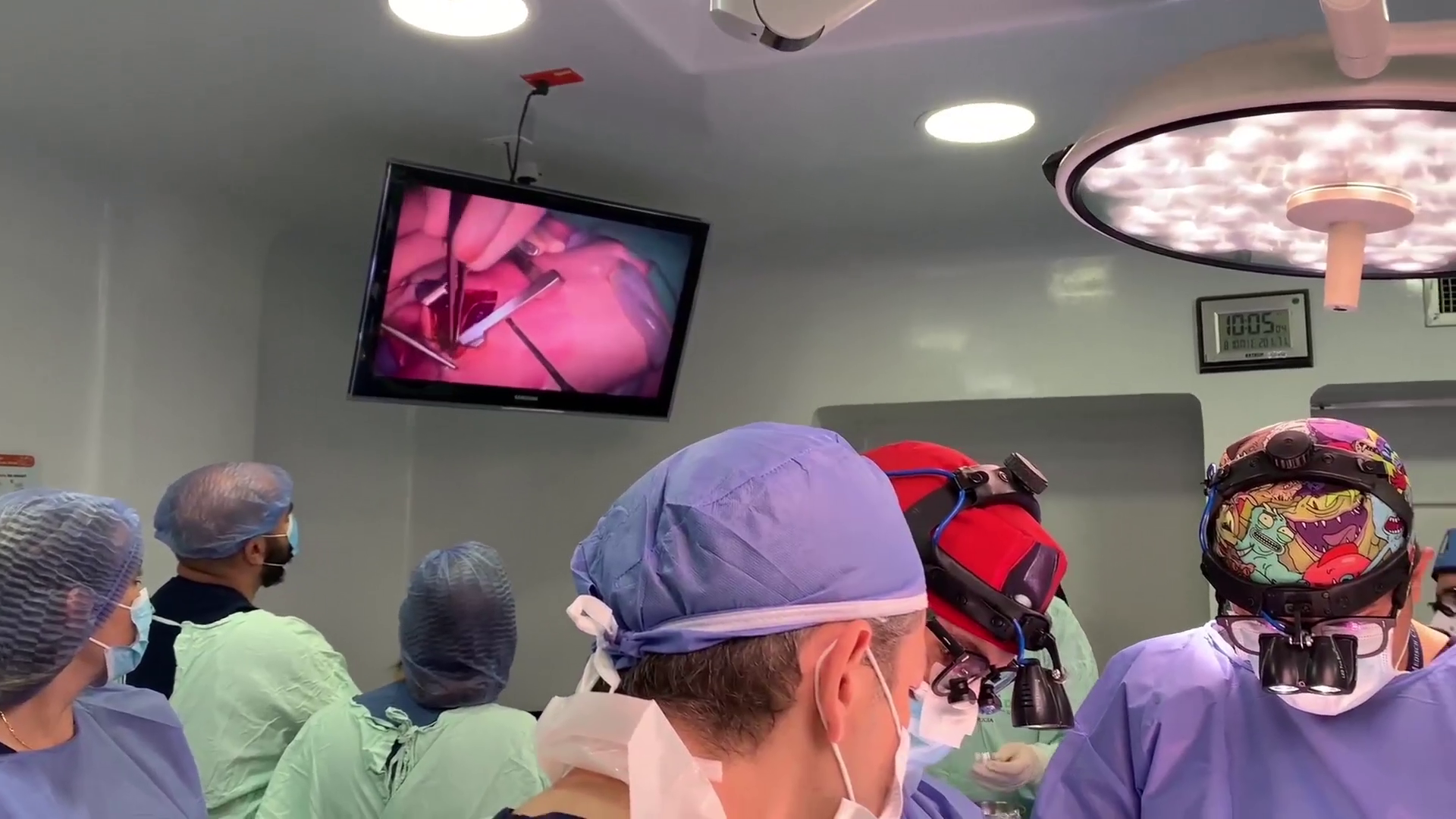 Una bebé es operada mientras aún permanecía conectada a la placenta de su madre