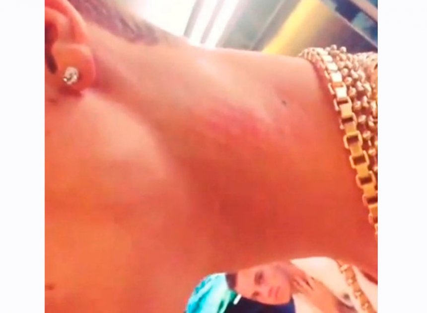 Justin Bieber se cae por las escaleras