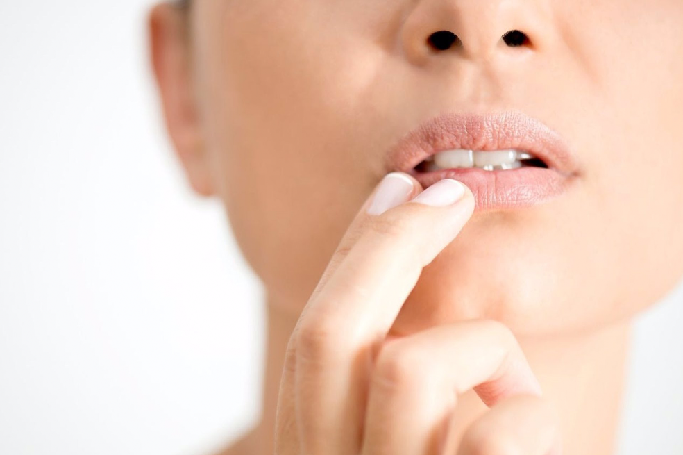 claves para cuidar el herpes labial