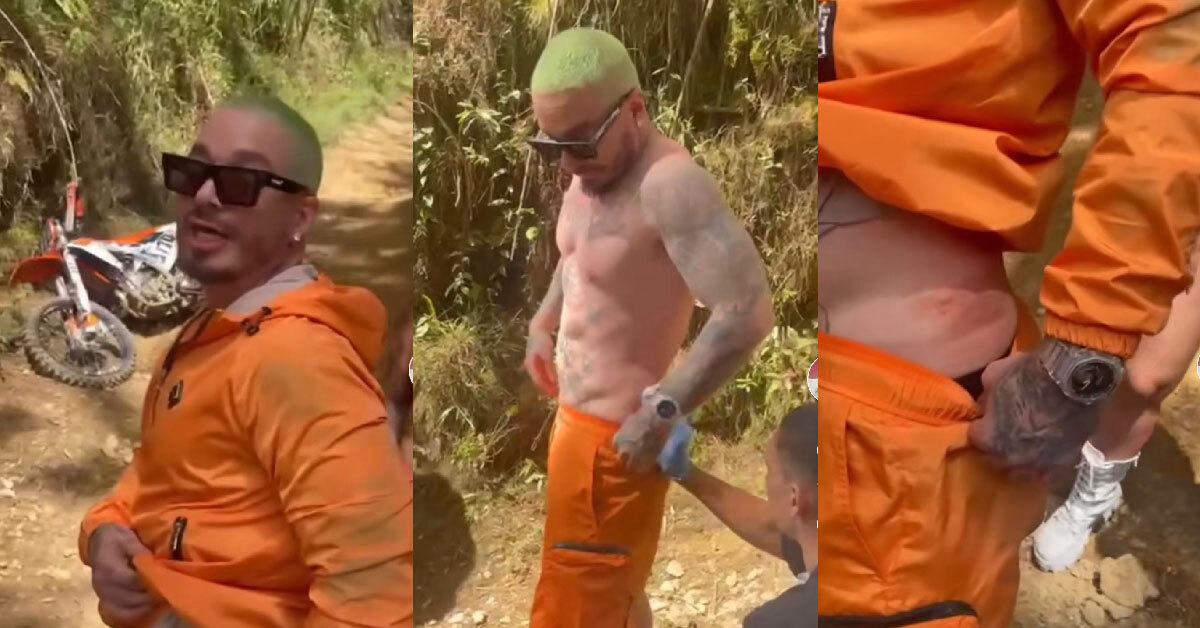 J Balvin sufrió fuerte caída mientras manejaba una moto y sufrió lesiones