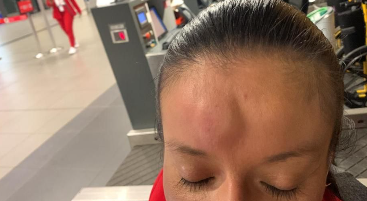 DJ caleña le dio un cabezazo a funcionaria del Aeropuerto El Dorado