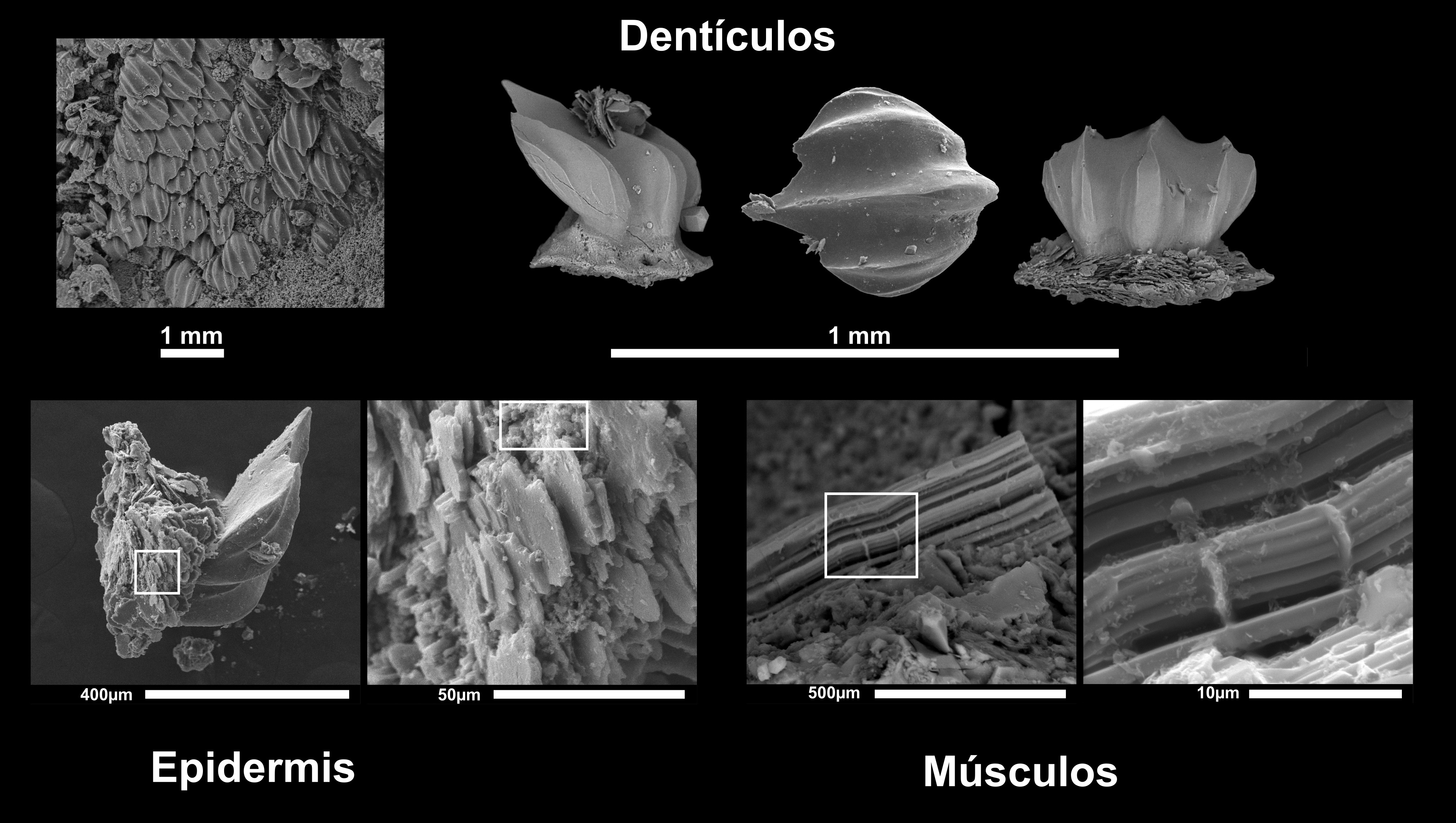 Imagen microscópica de dentículos y tejidos blandos.