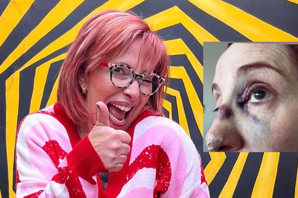 ¿Qué le pasó a Yaneth Waldman?: “tengo un par de fracturas”