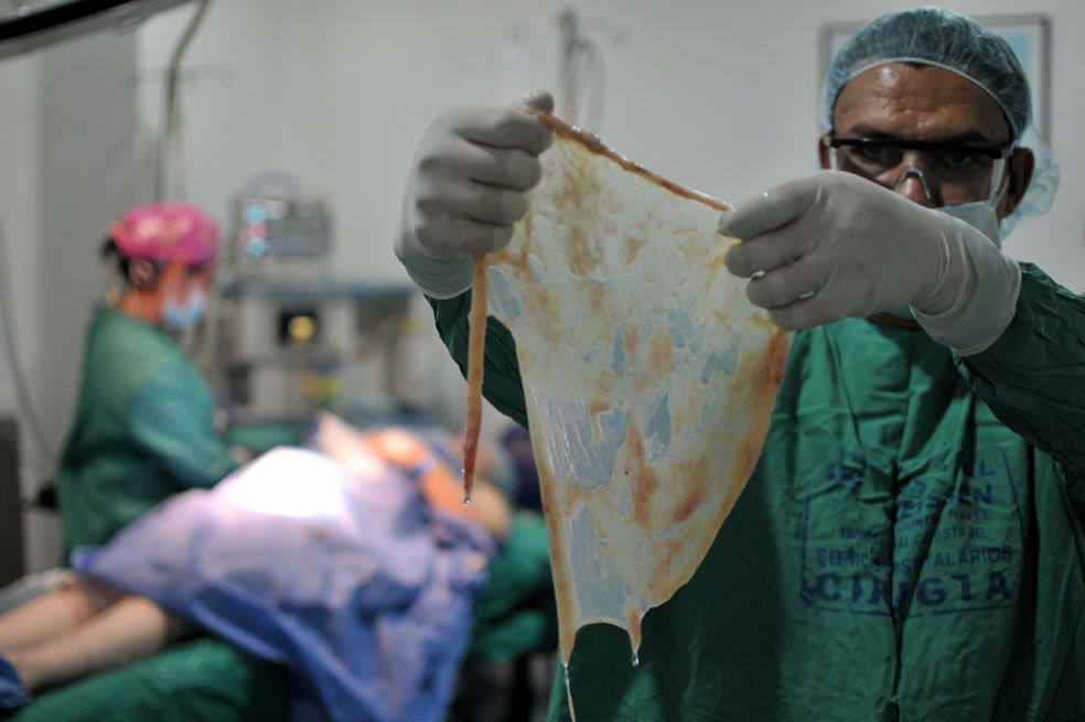 Placenta en el menú