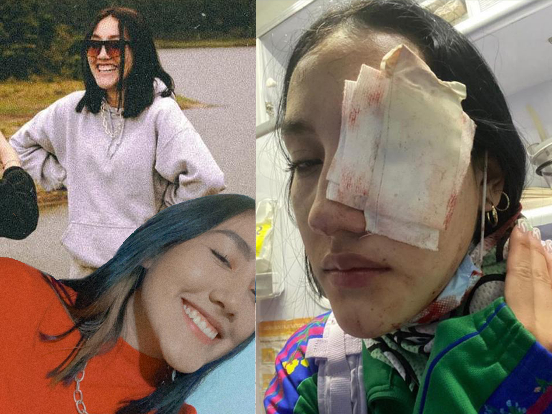 “Nos quitaron un ojo, pero seguimos teniendo nuestra voz”: Leidy Cadena