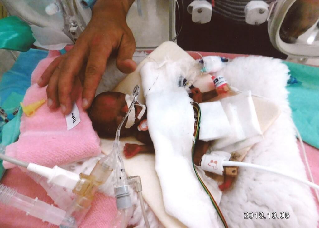 El ‘bebé más pequeño del mundo’ saldrá del hospital este fin de semana