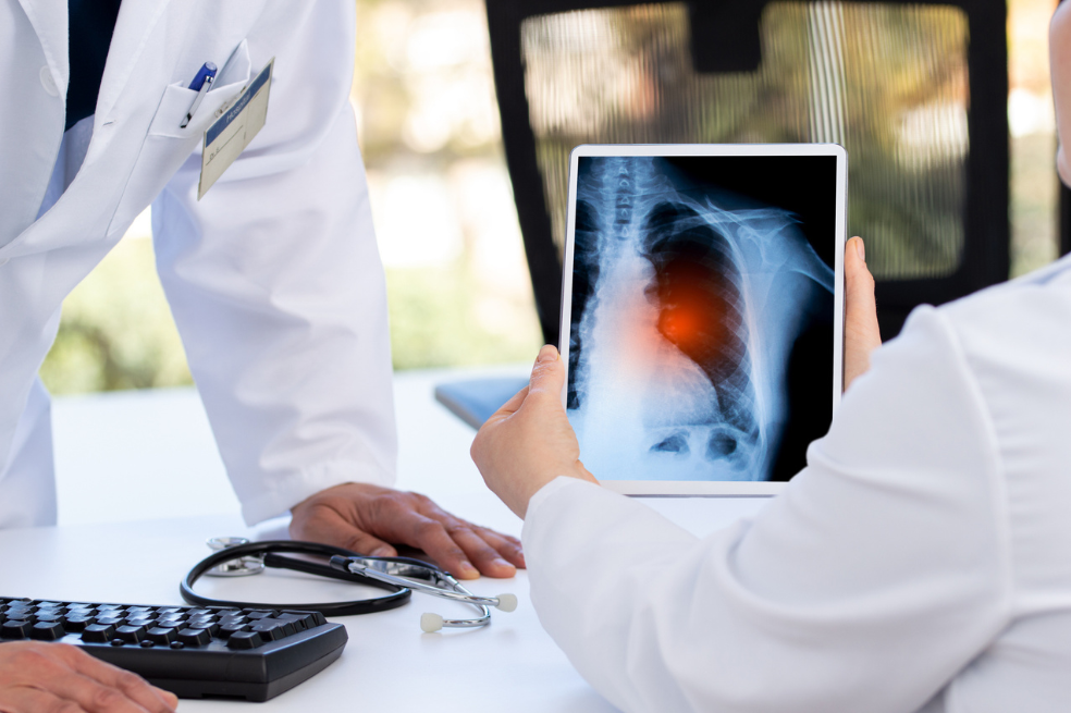 ¿Qué hacer si tienes hipertensión pulmonar? Expertos hallan una forma de tratarla