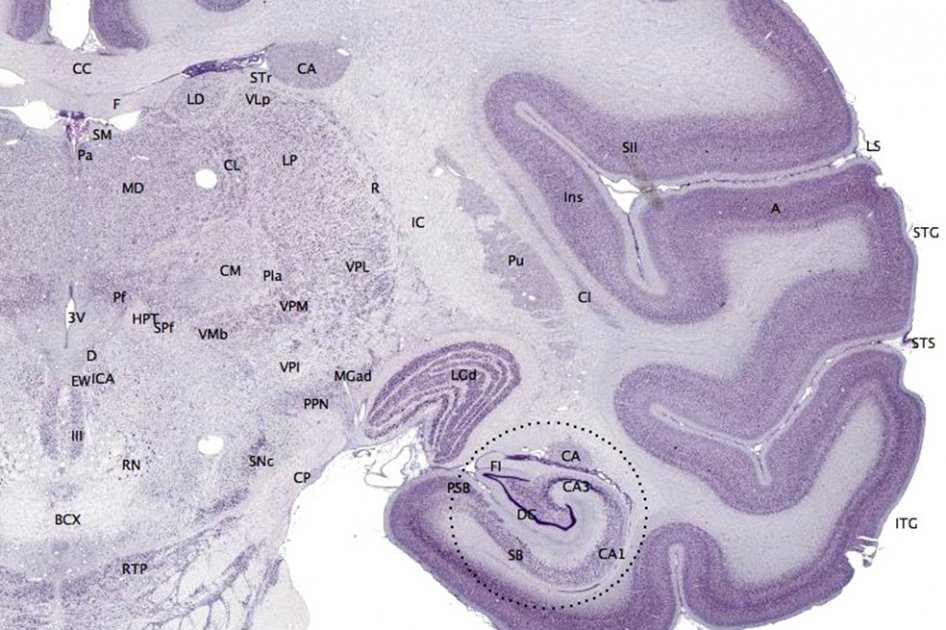 Neuronas en el cortex o capa superficial del cerebro de un mono.