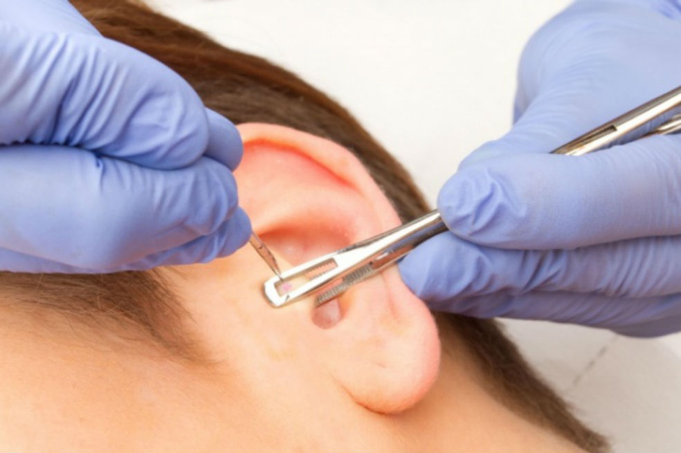 Daith piercing, ¿la solución para la migraña?
