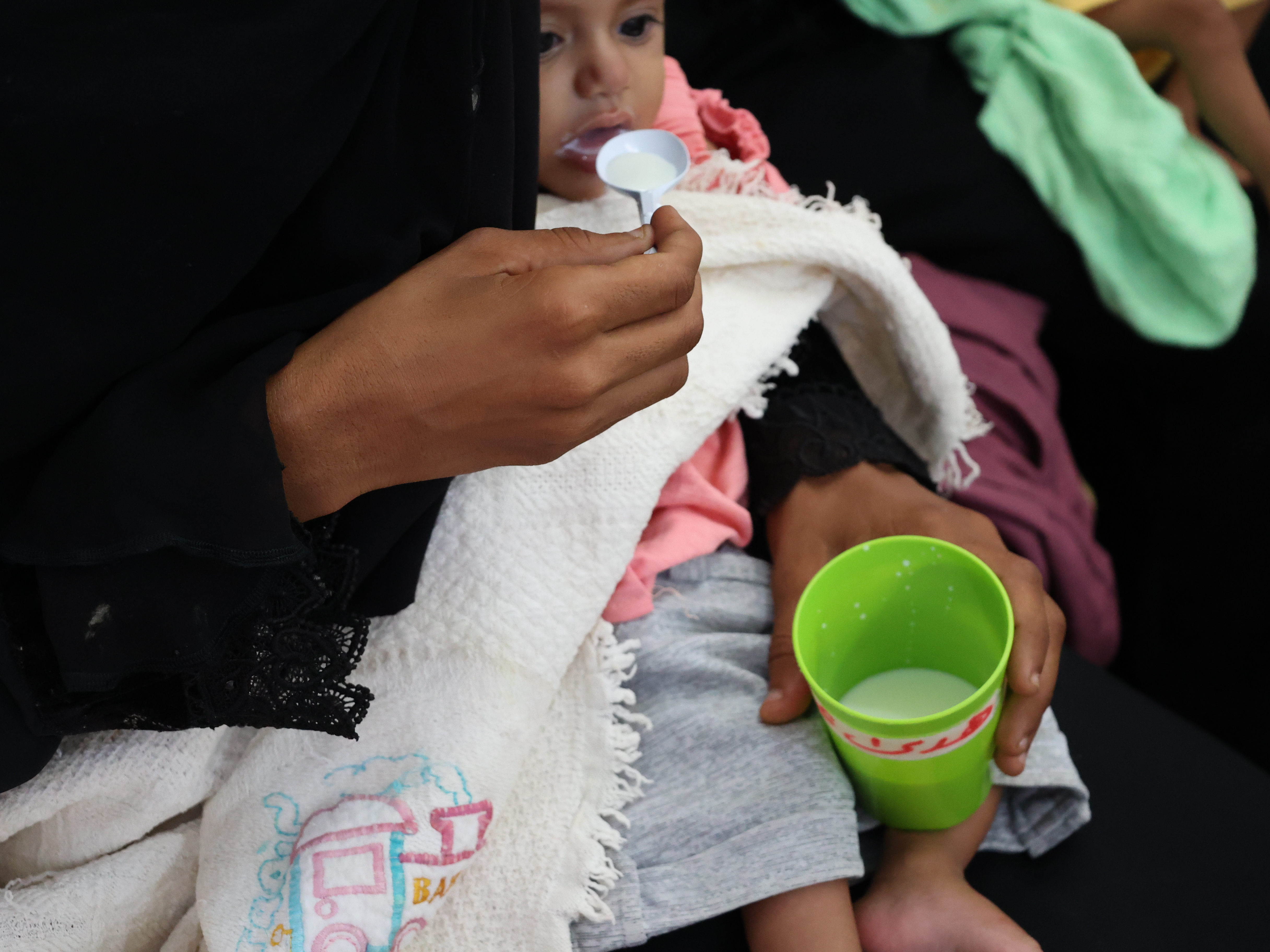 Yemen: cinco razones por las que la desnutrición infantil aguda está aumentando