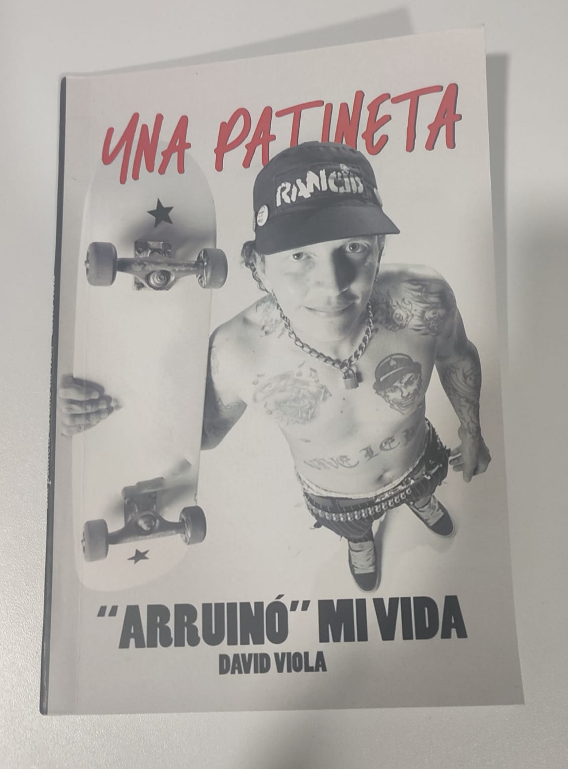 "Una patineta arruinó mi vida"
