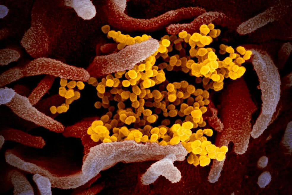 Así luce el coronavirus bajo el microscopio