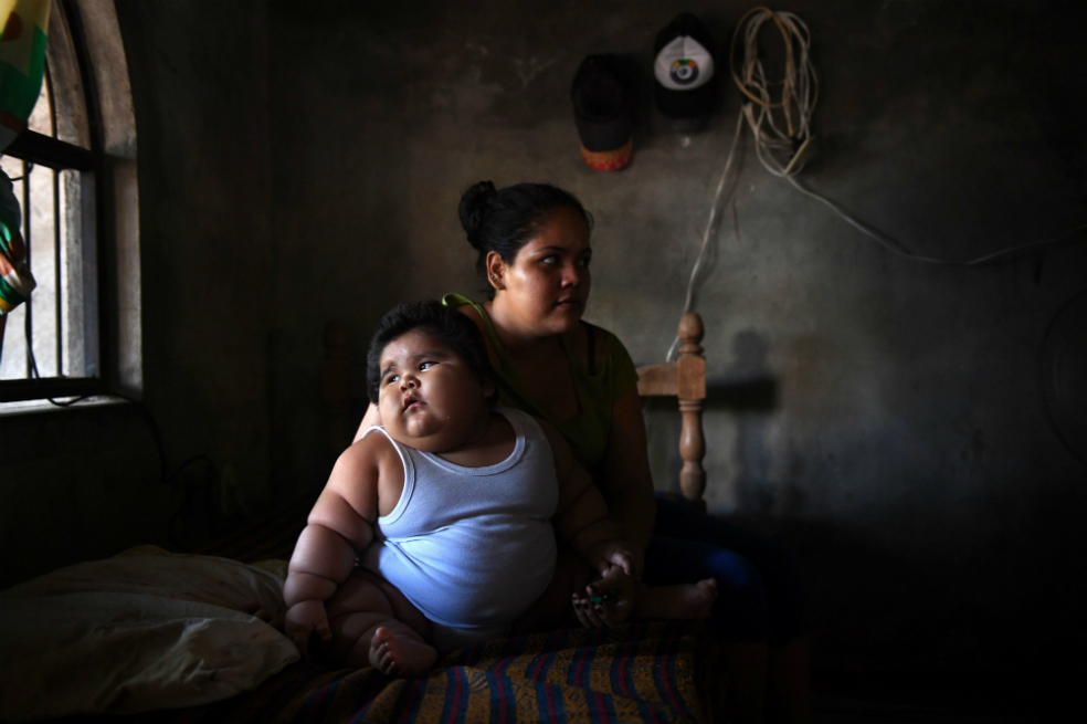Luis González, el niño de 10 meses que pesa 28 kilos
