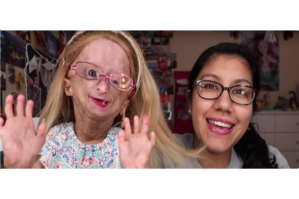 Adalia Rose, niña famosa en redes sociales que padece envejecimiento prematuro