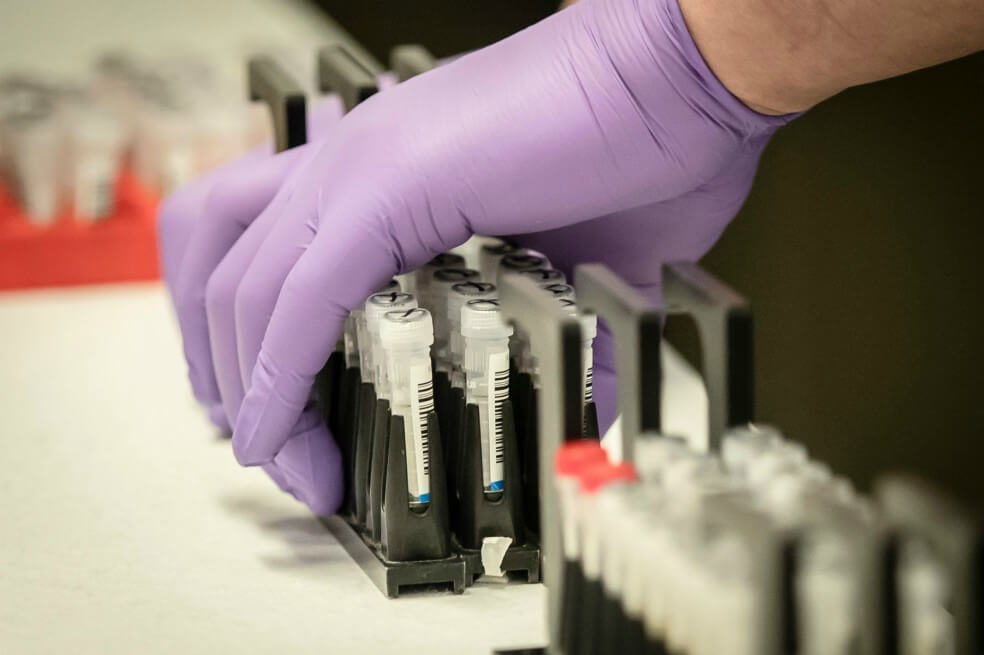 Coronavirus en Bogotá: así se comenzarán a utilizar las pruebas rápidas