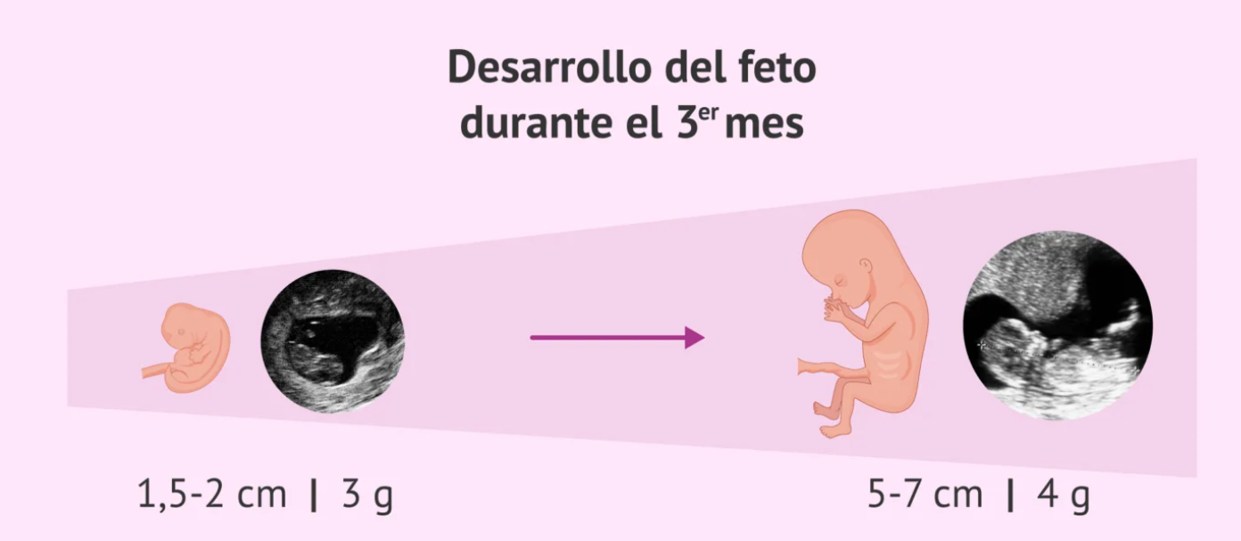 Así se ve un feto con tres meses de embarazo.
