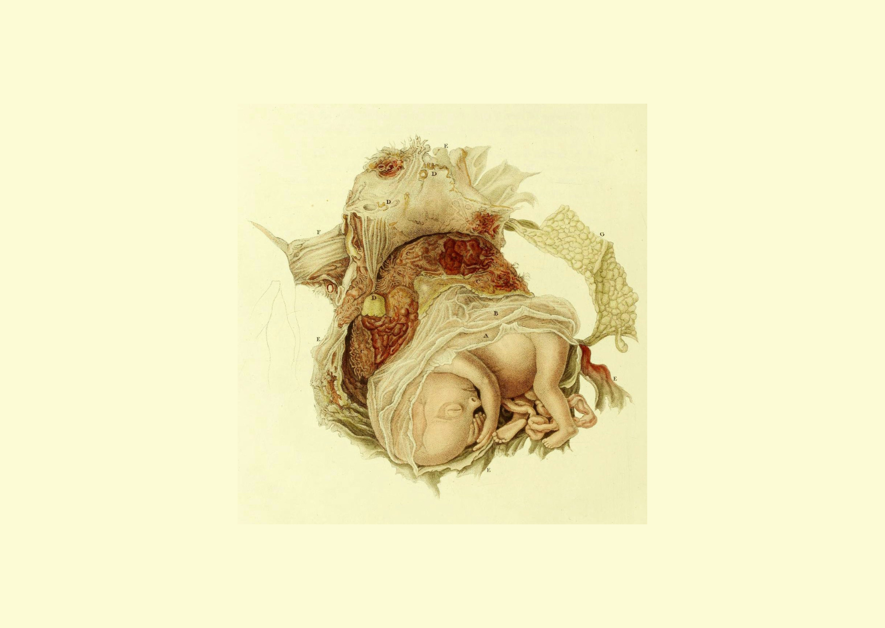 El artista Joseph Perry colaboró con Granville en el libro publicado en 1834 llamado: "Ilustraciones gráficas del aborto, con prolegómenos del desarrollo y metamorfosis del óvulo humano".