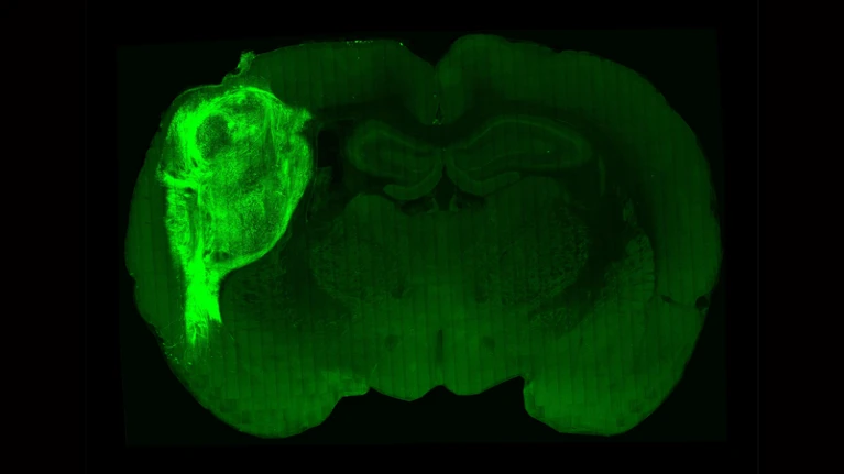 Implantaron neuronas humanas en ratas para estudiar mejor algunas enfermedades