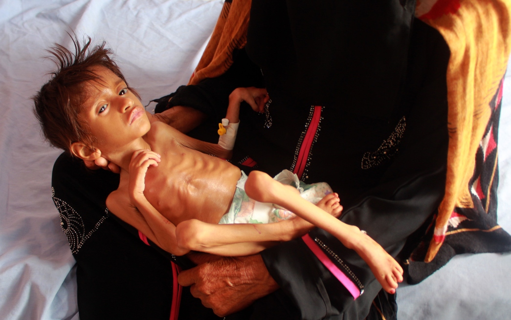 Yemen lleva seis años de guerra; miles de niños mueren entre las bombas y el hambre.