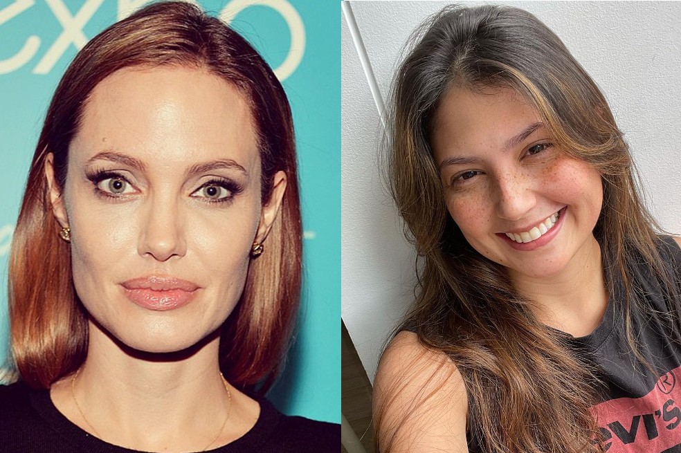 Laura Rodríguez, Angelina Jolie y otros famosos que sufrieron parálisis facial