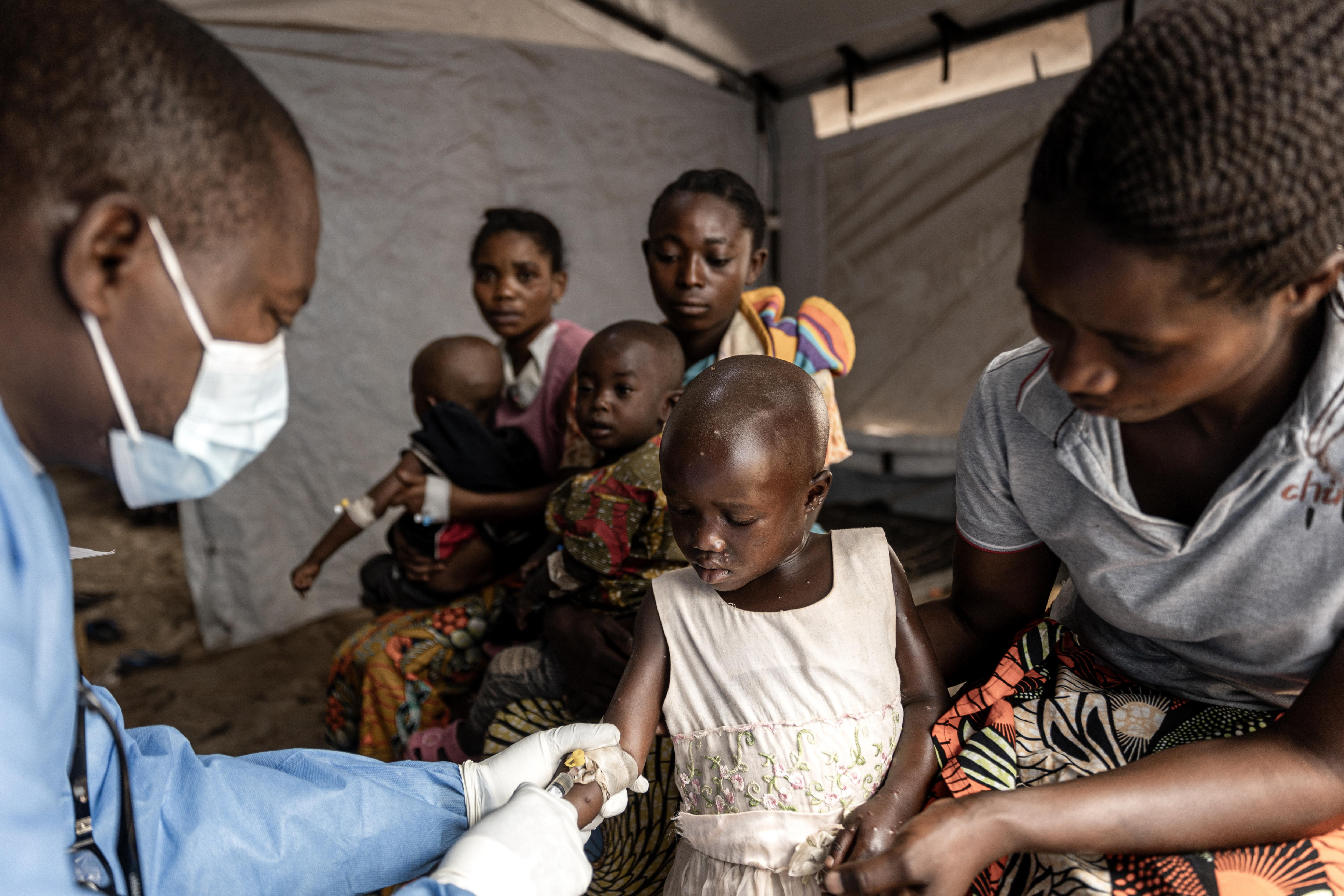 Llegan las primeras vacunas contra la mpox a la República Democrática del Congo
