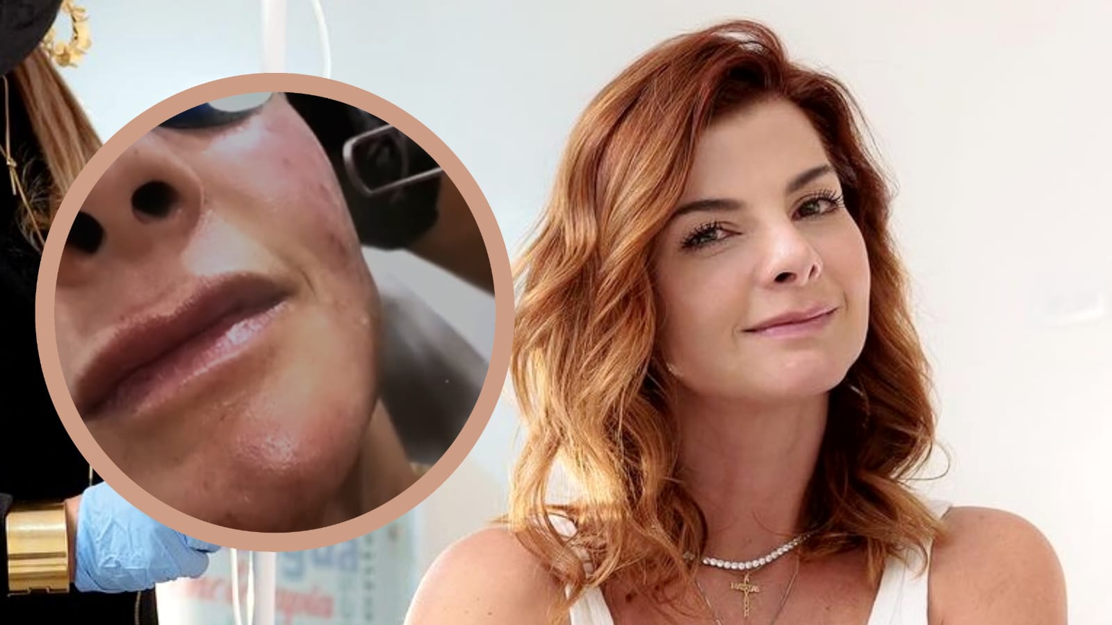 Carolina Cruz antes y ahora: así ha cambiado gracias a su tratamiento de piel