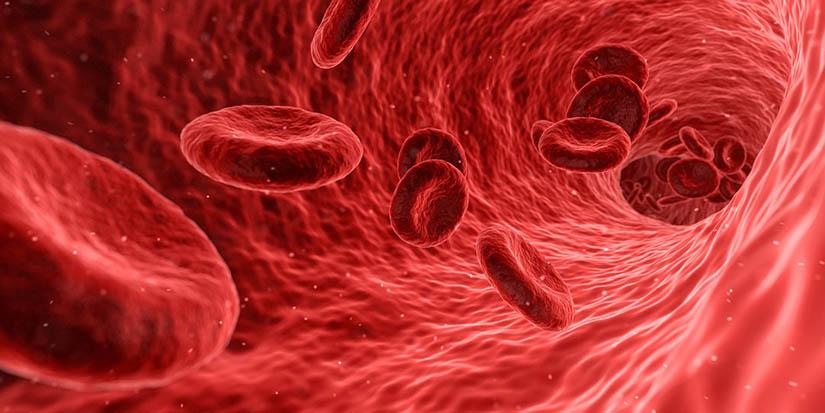 Jugos para la anemia: Estas opciones te ayudarán a mejorar los síntomas