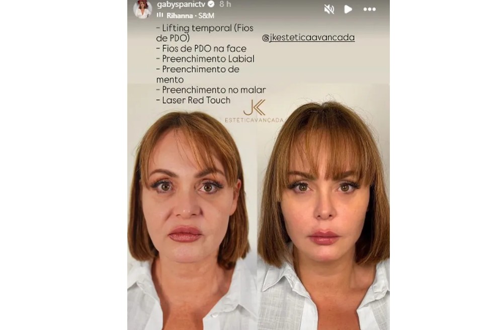 Gaby Spanic antes y después.