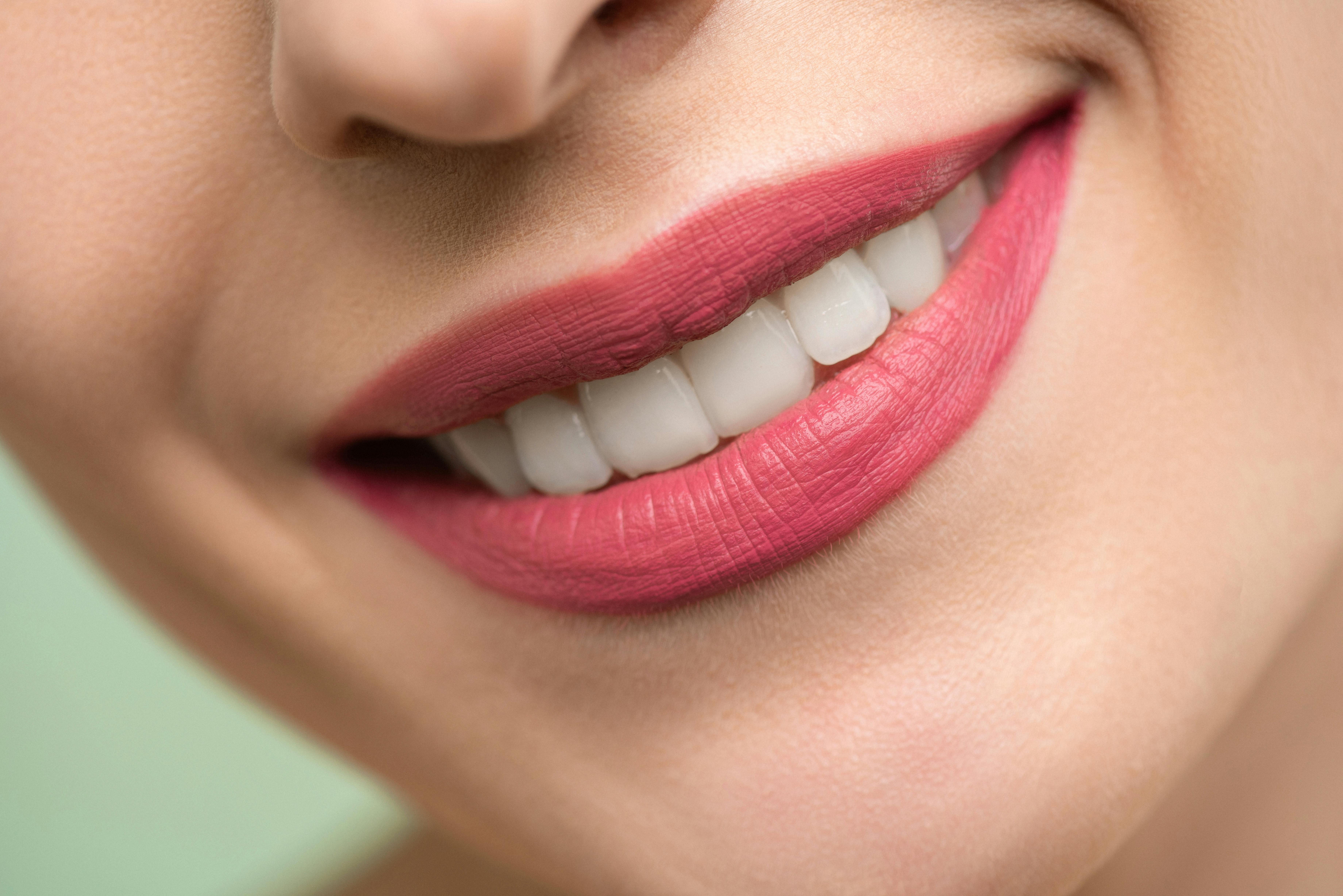 Cinco claves para mantener tu diseño de sonrisa: cuida tu inversión