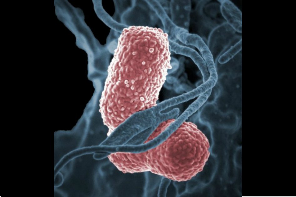 Mujer fallece por una bacteria resistente a los fármacos