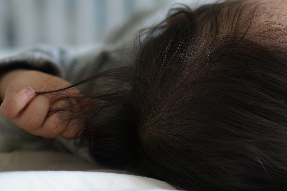 ¿Cómo evitar que a mi bebé se le caiga el pelo?