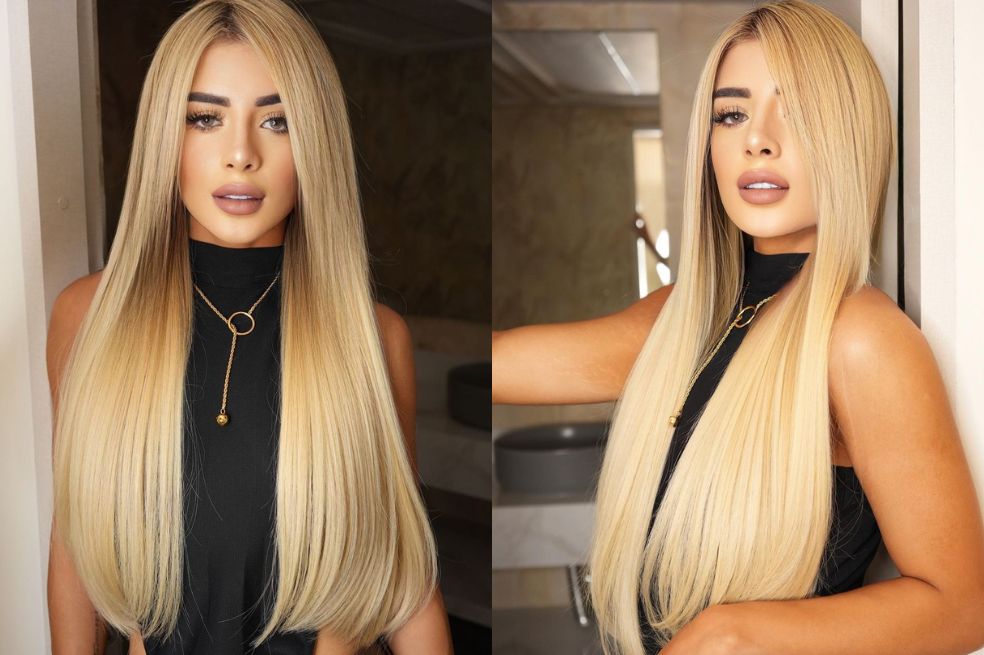Rafaella luchó contra el sobrepeso: “decían que si me cortaba se salía la grasa”