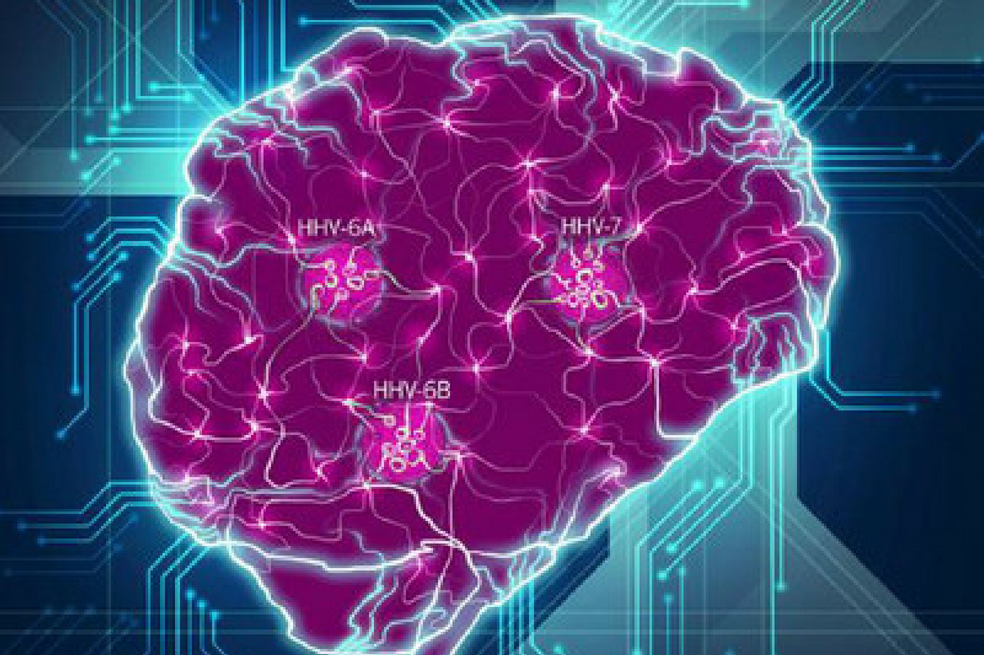 Nuevo estudio fortalece la teoría de que el virus del herpes causa alzhéimer