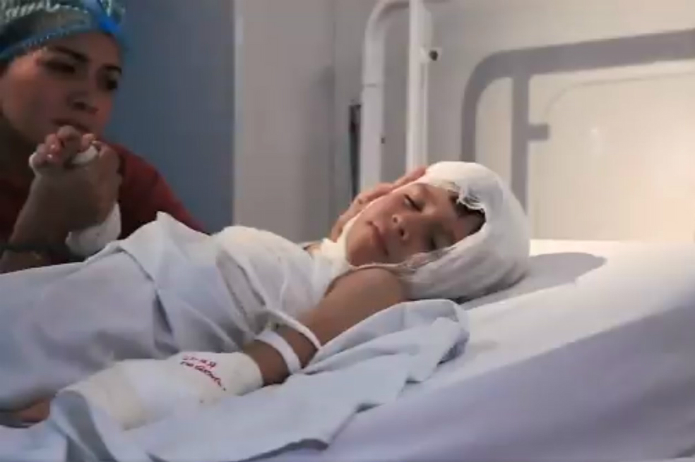 Amonestados 19 padres por niños quemados con pólvora: ICBF
