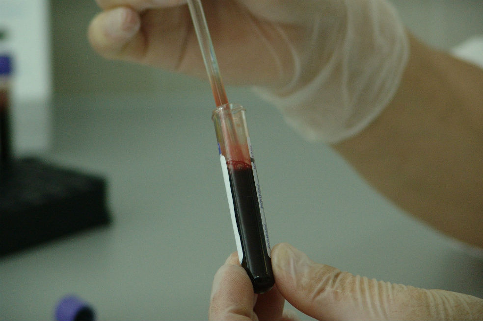 El único participante con un reservorio de VIH detectable recibió un trasplante de sangre de cordón umbilical –el resto fue de médula ósea– y tardó 18 meses en reemplazar todas sus células por las células del donante. / Pixabay