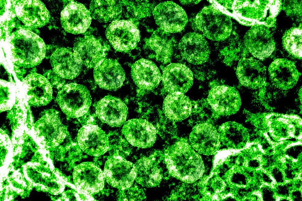 El coronavirus retratado por los científicos