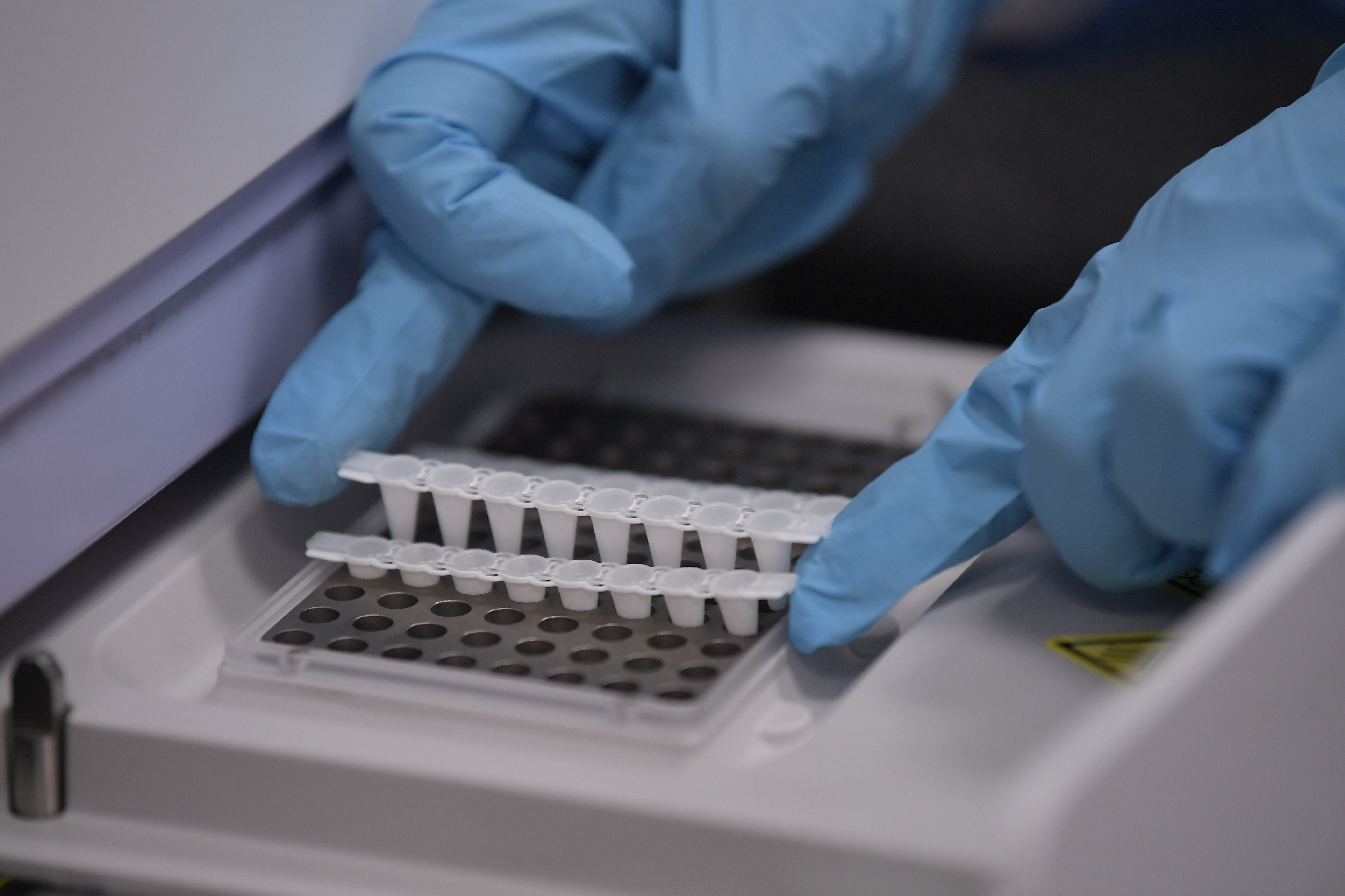 Trasplante de heces es eficaz contra una agresiva bacteria que afecta el colón