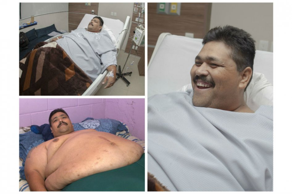 Sin complicaciones fue operado el hombre más obeso del mundo