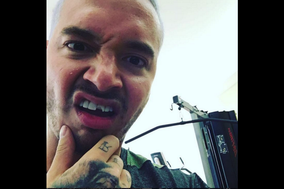 J Balvin se quebró un diente y creó tendencia en redes