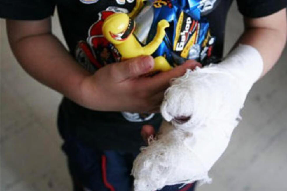 A la cárcel madre que habría quemado las manos de su hijo de 9 años con ayuda de la abuela