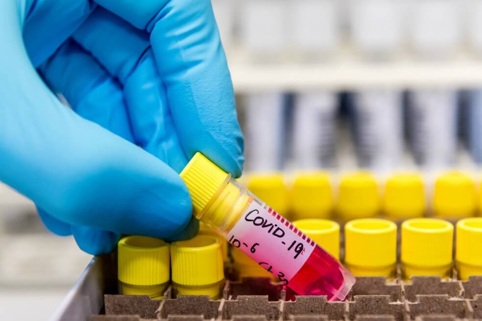 Los más ricos del mundo pierden US$440.000 millones por el coronavirus