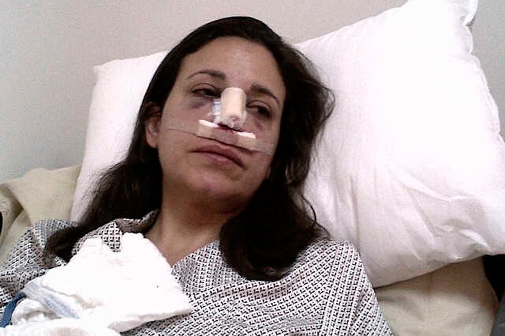 Así quedó la nariz de María Corina Machado tras golpiza