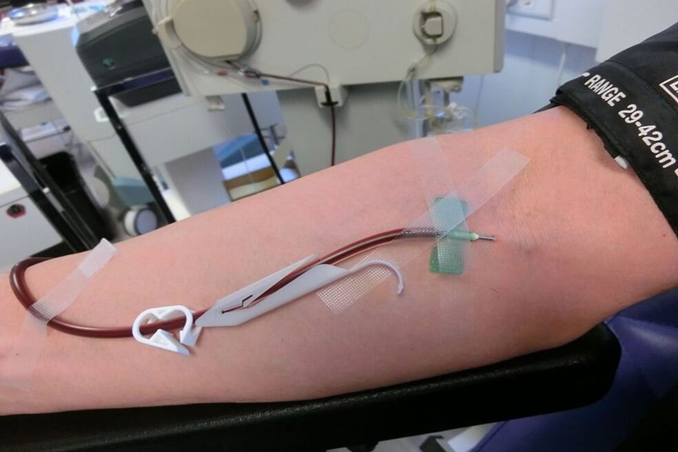 El plasma de sobrevivientes de coronavirus podría ayudar a otros pacientes infectados