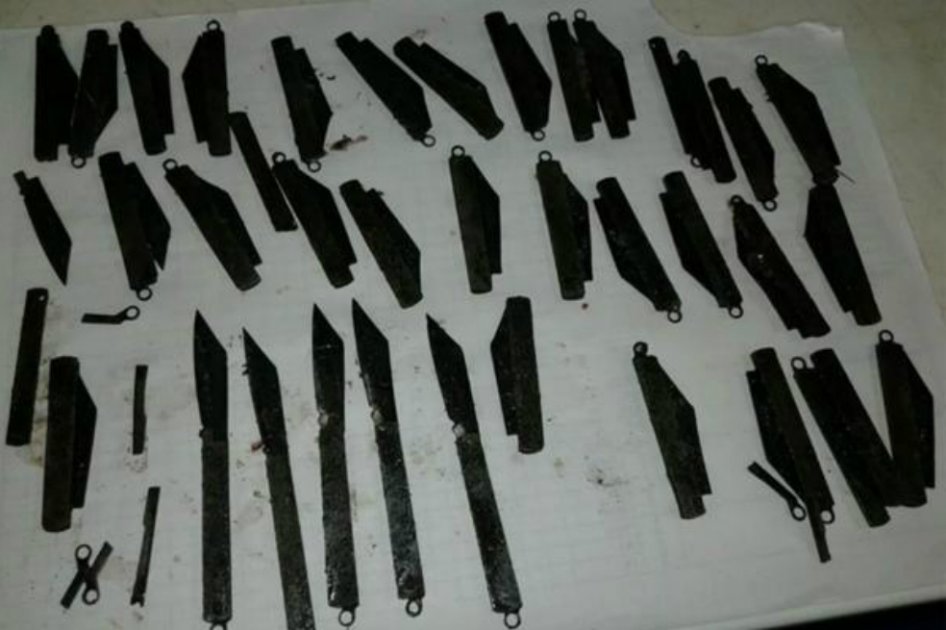 Tenía un dolor abdominal y le encontraron 40 navajas en el estómago