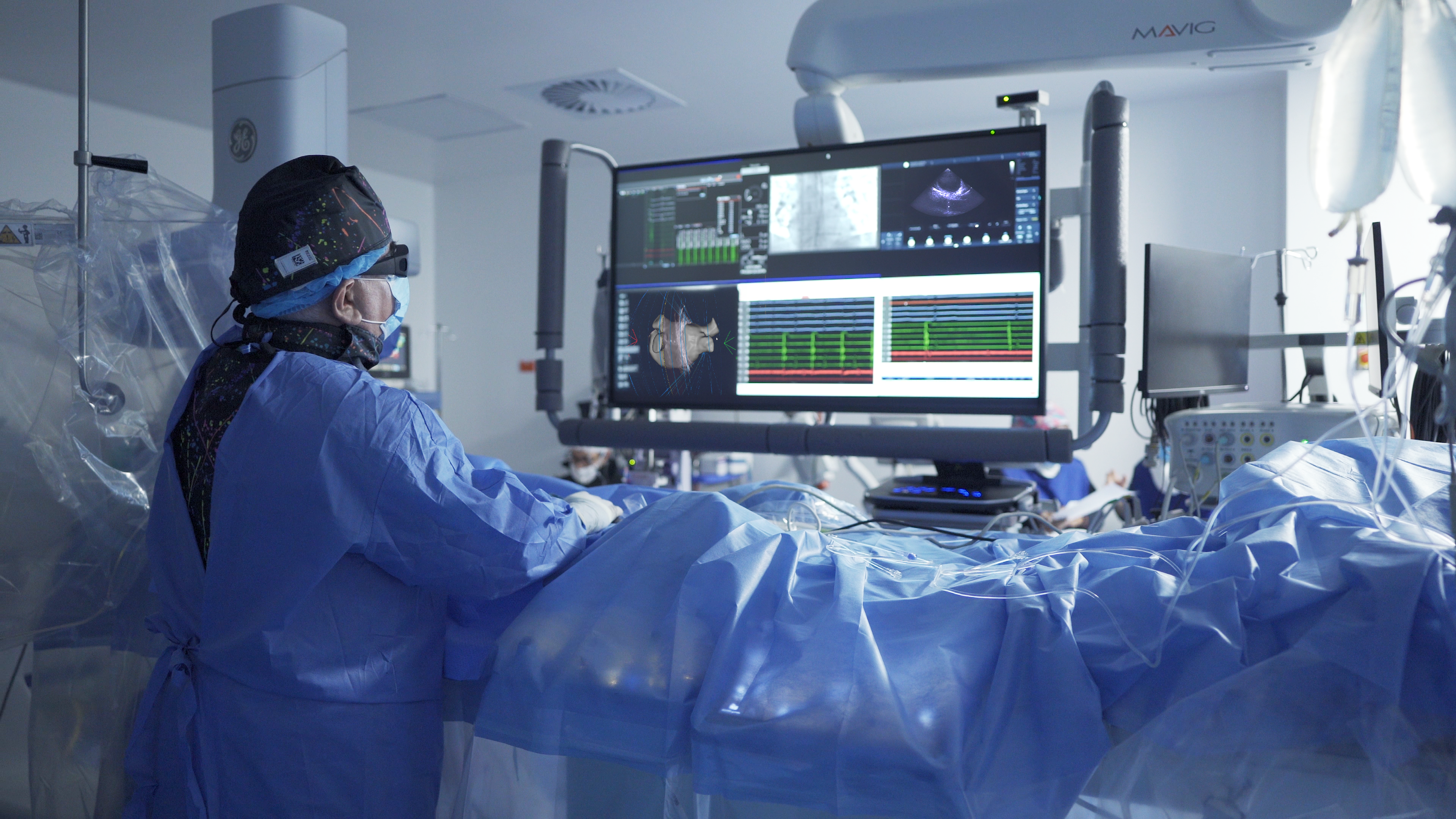 Nueva tecnología con IA revoluciona el tratamiento de arritmias cardiacas