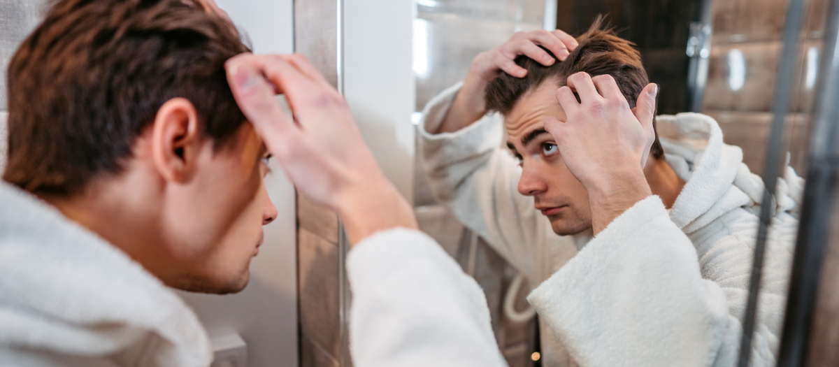 Implantes capilares: una opción popular para tratar la pérdida de cabello