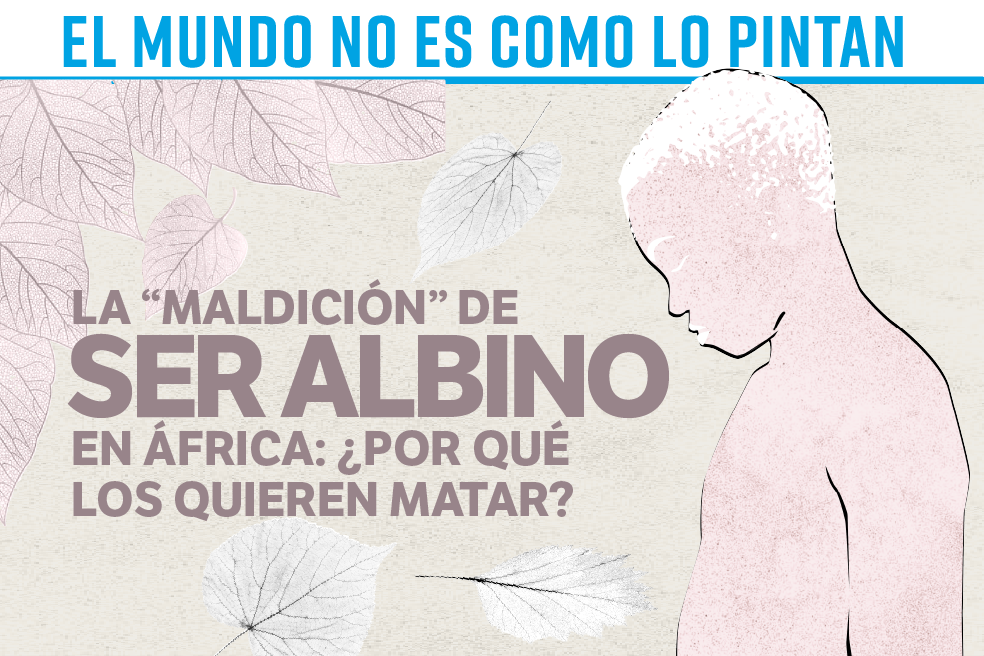 La “maldición” de ser albino en África: ¿por qué los quieren matar?