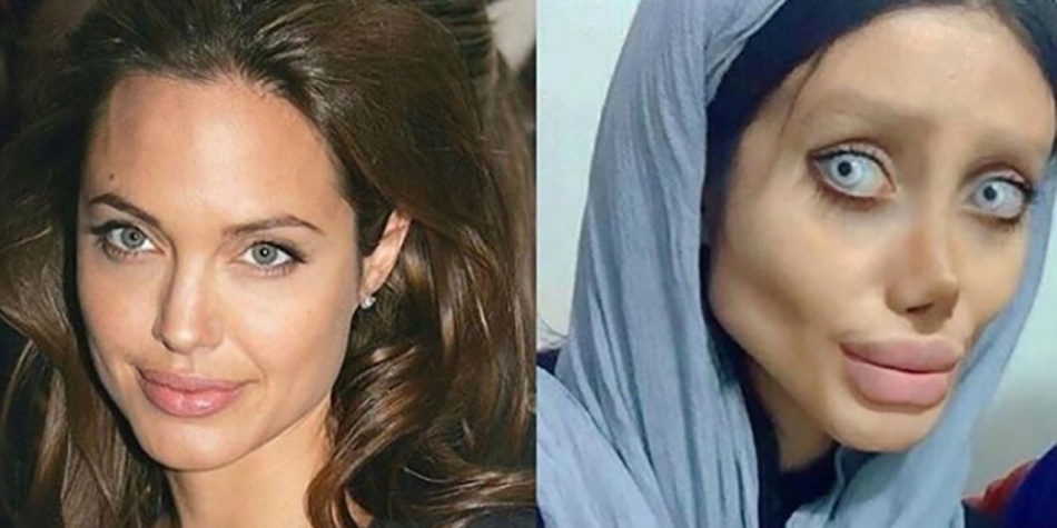 Sahar Tabar, la joven que se ha realizado 50 cirugías para parecerse a Angelina Jolie