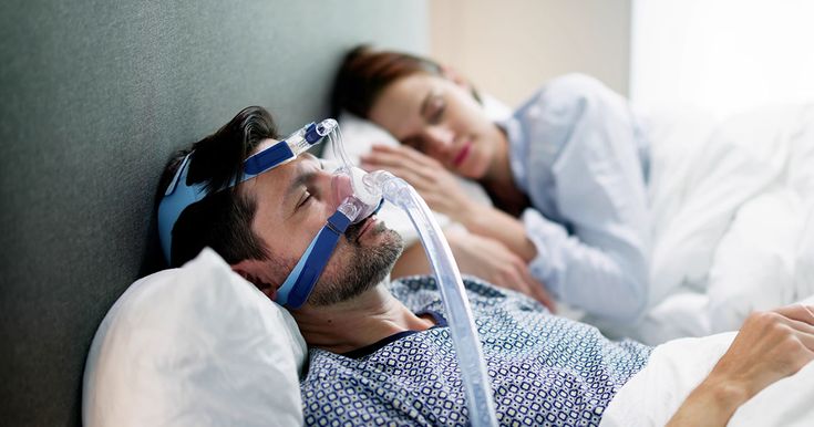 ¿Qué es la apnea obstructiva del sueño y cuáles son sus síntomas?
