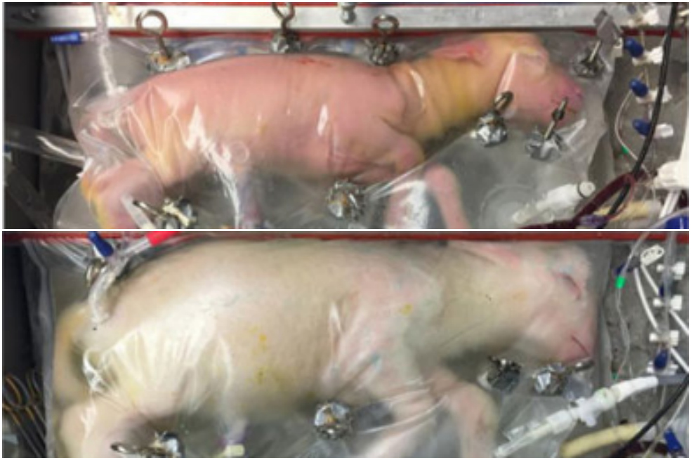 El útero artificial para bebés prematuros que esperan desarrollar médicos holandeses